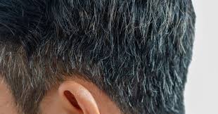 केस पांढरे होण्याची कारणे व उपाय | केस दाट होण्यासाठी काय खावे?